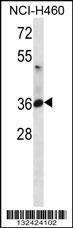 Anti-ATP1B3 (C-term) Antibody