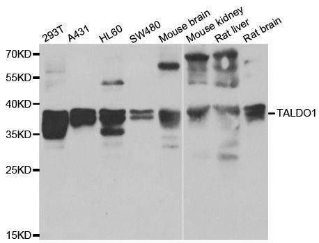 Anti-TALDO1 Antibody