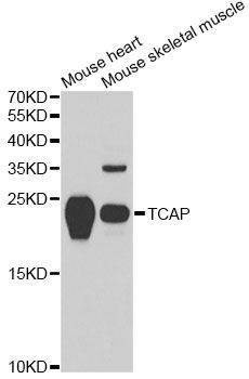 Anti-TCAP Antibody
