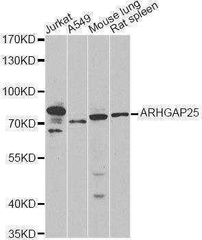Anti-ARHGAP25 Antibody