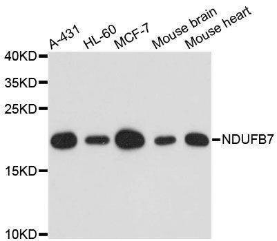 Anti-NDUFB7 Antibody