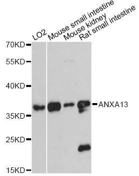 Anti-ANXA13 Antibody