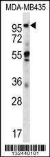 Anti-CTAGE5 (C-term) Antibody