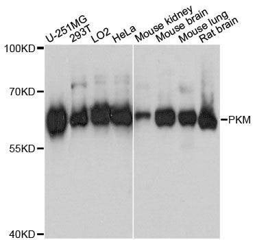 Anti-PKM Antibody