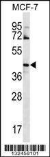 Anti-GNA14 (N-term) Antibody