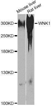 Anti-WNK1 Antibody