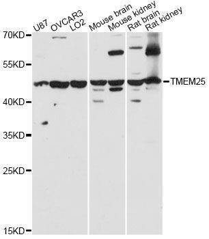 Anti-TMEM25 Antibody