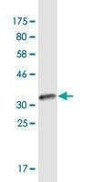 Anti-CARD17 Antibody