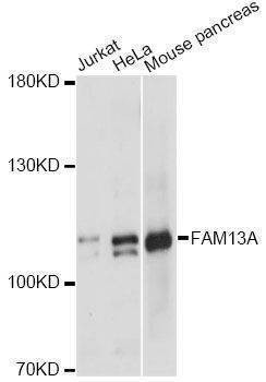 Anti-FAM13A Antibody