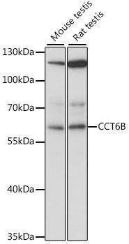 Anti-CCT6B Antibody