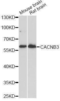 Anti-CACNB3 Antibody