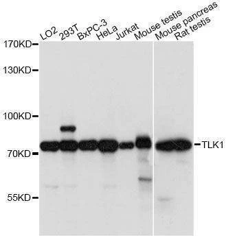 Anti-TLK1 Antibody