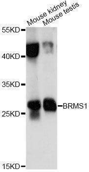 Anti-BRMS1 Antibody