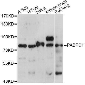 Anti-PABPC1 Antibody