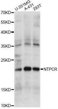 Anti-NTPCR Antibody