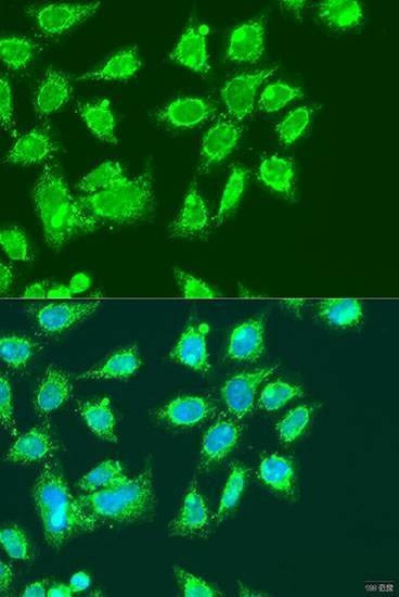 Anti-MCCC2 Antibody
