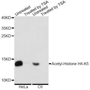 Anti-H4K5AC Antibody