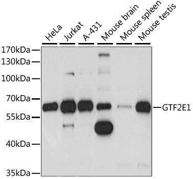 Anti-GTF2E1 Antibody