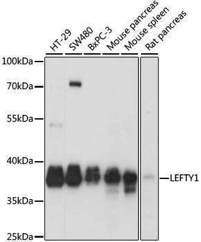 Anti-LEFTY1 Antibody