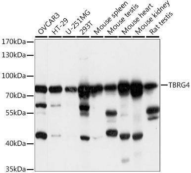 Anti-TBRG4 Antibody