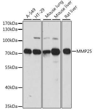 Anti-MMP25 Antibody