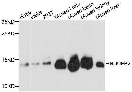 Anti-NDUFB2 Antibody