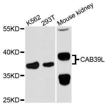 Anti-CAB39L Antibody