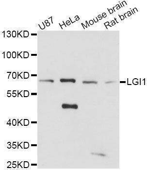 Anti-LGI1 Antibody
