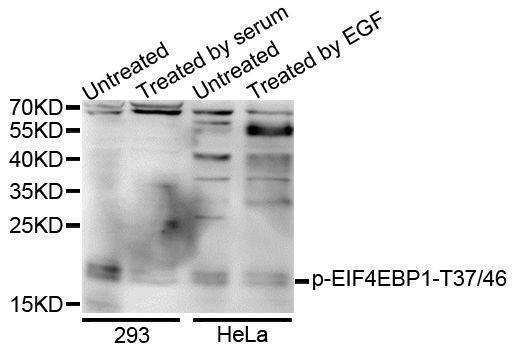 Anti-EIF4EBP1 Antibody
