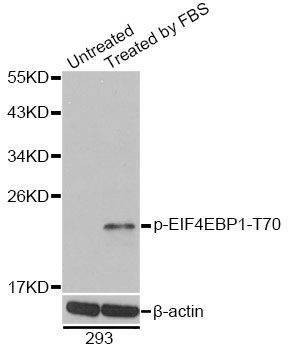 Anti-EIF4EBP1 Antibody