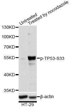 Anti-TP53 Antibody