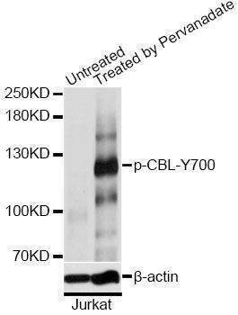 Anti-CBL Antibody