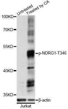 Anti-NDRG1 Antibody