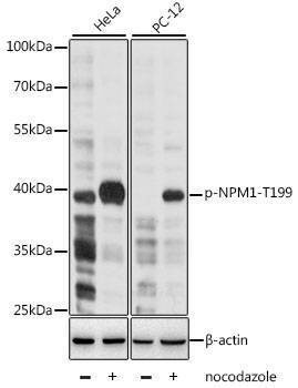Anti-NPM1 Antibody