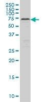 Anti-CARF Antibody