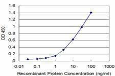 Anti-CARF Antibody