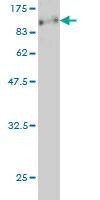 Anti-CARF Antibody