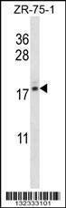 Anti-TNP2 (C-term) Antibody