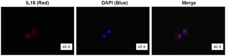 Anti-IL18 Antibody