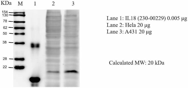 Anti-IL18 Antibody