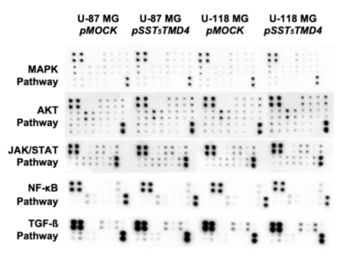 RayBiotech’s Human Phosphorylation Pathway Profiling Array identified oncogenic pathway alterations in glioblastoma cells overexpressing sst5TMD4. Figure adapted from Fuentes-Fayos et al., Int. J. Mol. Sci., 2022.