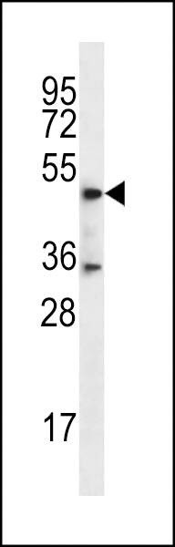 Anti-DSN1 (C-term) Antibody