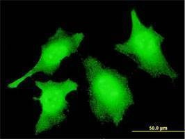 Anti-CASP2 Antibody