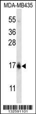 Anti-HIST1H2BC/HIST1H2BF (N-term) Antibody