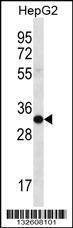 Anti-SULT1A3/SULT1A4 (N-term) Antibody