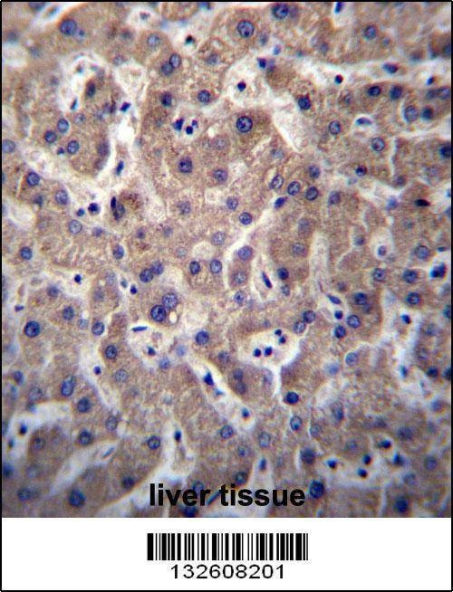 Anti-SULT1A3/SULT1A4 (N-term) Antibody