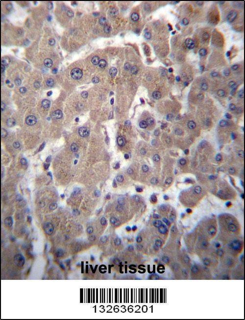 Anti-YIPF1 (N-term) Antibody