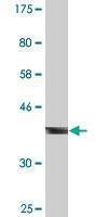 Anti-CBL Antibody