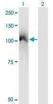 Anti-CBL Antibody