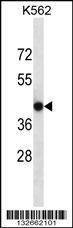 Anti-CACNG4 (Center) Antibody